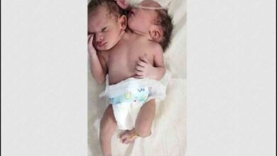 Photo of MP में दो सिर और तीन हाथ वाले अनोखे बच्‍चे का जन्‍म,डॉक्टर बोले- साइंस का चमत्कार, देखिए तस्वीर