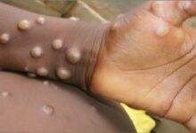 Photo of Monkeypox: कोरोना के बाद अब इस वायरस से बच्चों को खतरा, ICMR ने किया अलर्ट, जाने कैसे करें बचाव
