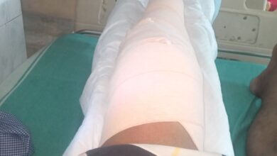 Road Accident in Singrauli - बुलेट सवार पंप संचालक को बोलेरो ने मारी टक्कर, बाया पैर टूटा, बनारस रेफर