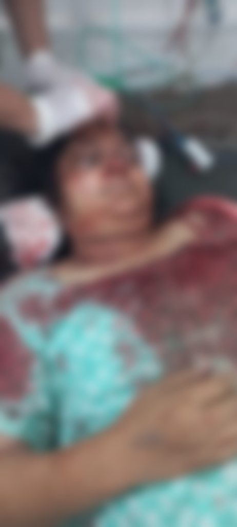 Katni Big breaking News: उद्योगपति संजय मित्तल की पत्नी ने खुद को मारी गोली, बेटे की मौत के बाद से तनाव में रहती थी