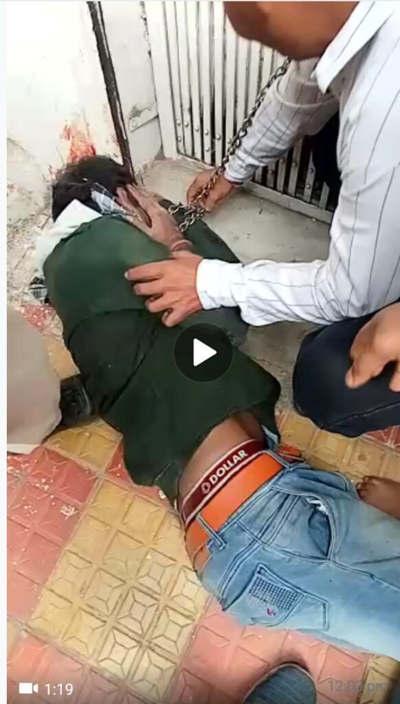 Chhindwara news : डकैती के इरादे से आए आरोपियों ने ज्वेलर्स संचालक के पेट और पैर में मारी गोली, हालत गंभीर