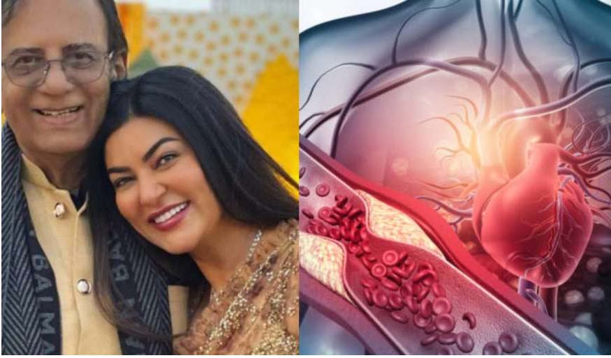 Sushmita Sen hot attack : मिस यूनिवर्स सुष्मिता सेन को आया हार्ट अटैक, एंजियोप्लास्टी के बाद ऐसी है सेहत
